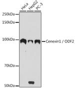 ODF2 Recombinant Rabbit Monoclonal Antibody (3Z1H8)