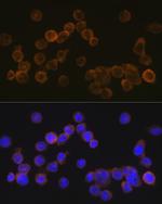 CD35 Antibody in Immunocytochemistry (ICC/IF)
