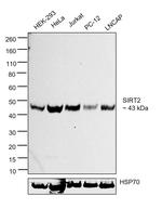 SIRT2 Recombinant Rabbit Monoclonal Antibody (1E1U3)