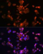 LXR alpha Antibody in Immunocytochemistry (ICC/IF)