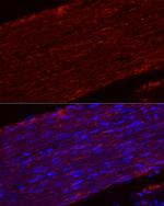 MYH11 Antibody in Immunohistochemistry (Paraffin) (IHC (P))