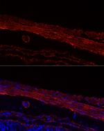 MYH11 Antibody in Immunohistochemistry (Paraffin) (IHC (P))