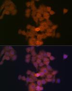 PFDN5 Recombinant Rabbit Monoclonal Antibody (9Y5H7)