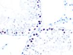 HAT1 Antibody in Immunohistochemistry (Paraffin) (IHC (P))