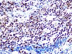 HAT1 Antibody in Immunohistochemistry (Paraffin) (IHC (P))