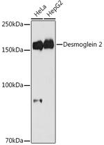 Desmoglein 2 (DSG2) Antibody in Western Blot (WB)
