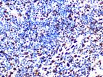 SAMHD1 Recombinant Rabbit Monoclonal Antibody (4C7B3)