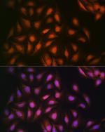 DISC1 Antibody in Immunocytochemistry (ICC/IF)