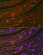 Dystrophin Antibody in Immunocytochemistry (ICC/IF)