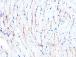Dystrophin Antibody in Immunohistochemistry (Paraffin) (IHC (P))