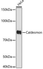 Caldesmon Recombinant Rabbit Monoclonal Antibody (6M5Q9)