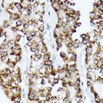 CDCA3 Recombinant Rabbit Monoclonal Antibody (1J5L2)