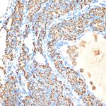Cytochrome P450 Reductase Antibody in Immunohistochemistry (Paraffin) (IHC (P))