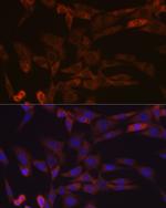 Activin A Recombinant Rabbit Monoclonal Antibody (1X6N9)