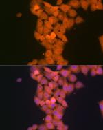 p53DINP1 Recombinant Rabbit Monoclonal Antibody (9Y6Z7)