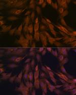 ULK3 Antibody in Immunocytochemistry (ICC/IF)