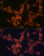 ULK3 Recombinant Rabbit Monoclonal Antibody (5Z7Z6)