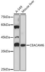 CEACAM6 Recombinant Rabbit Monoclonal Antibody (4Z3V7)