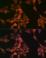 NAP1L1 Antibody in Immunocytochemistry (ICC/IF)