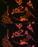 NAP1L1 Recombinant Rabbit Monoclonal Antibody (4W8B6)