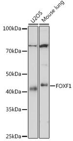 FOXF1 Recombinant Rabbit Monoclonal Antibody (8F6G3)