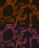 CAD Recombinant Rabbit Monoclonal Antibody (0O8D6)