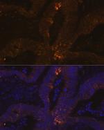 TFF1 Antibody in Immunohistochemistry (Paraffin) (IHC (P))