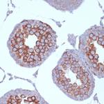 KIF3A Antibody in Immunohistochemistry (Paraffin) (IHC (P))
