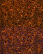 SULT2A1 Recombinant Rabbit Monoclonal Antibody (4A3H6)