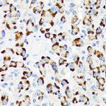 A-Raf Recombinant Rabbit Monoclonal Antibody (4U9L7)
