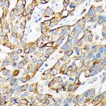 Cytokeratin 16 Recombinant Rabbit Monoclonal Antibody (8L6R4)