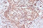 BAG2 Antibody in Immunohistochemistry (Paraffin) (IHC (P))
