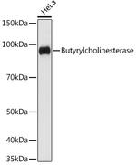 Butyrylcholinesterase Recombinant Rabbit Monoclonal Antibody (4N2N9)