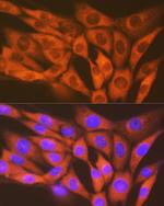 MST2 Recombinant Rabbit Monoclonal Antibody (5J1I4)