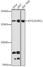 SRC1 Recombinant Rabbit Monoclonal Antibody (3S4C6)