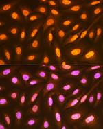 FUBP1 Recombinant Rabbit Monoclonal Antibody (1G6X5)