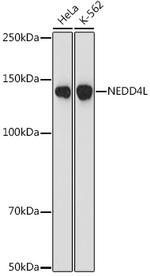 NEDD4L Recombinant Rabbit Monoclonal Antibody (3W9J2)