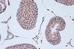KIF4A Antibody in Immunohistochemistry (Paraffin) (IHC (P))