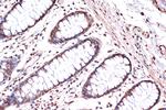 KIF4A Antibody in Immunohistochemistry (Paraffin) (IHC (P))