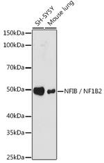 NFIB Recombinant Rabbit Monoclonal Antibody (7T1G5)