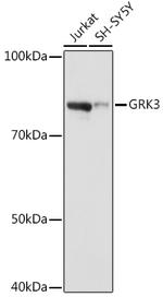 GRK3 Recombinant Rabbit Monoclonal Antibody (10O6S3)