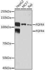 FGFR4 Recombinant Rabbit Monoclonal Antibody (2C4E1)