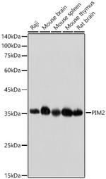 PIM2 Recombinant Rabbit Monoclonal Antibody (3V1S5)