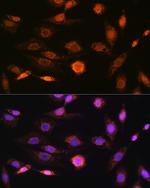 CaMKIV Recombinant Rabbit Monoclonal Antibody (1G4P4)