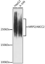 MRP2 Recombinant Rabbit Monoclonal Antibody (6L3Z6)