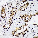 ILF2 Recombinant Rabbit Monoclonal Antibody (5P1K2)