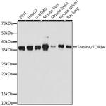 Torsin 1A Recombinant Rabbit Monoclonal Antibody (4Q2I9)