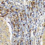 VAV3 Recombinant Rabbit Monoclonal Antibody (9A10D8)