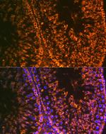 LIN28A Antibody in Immunohistochemistry (Paraffin) (IHC (P))