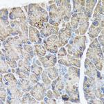 PLTP Antibody in Immunohistochemistry (Paraffin) (IHC (P))